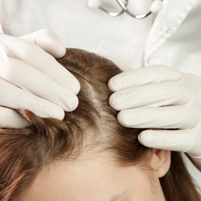 ONLINE HAIR LOSS SERUMS FOR WOMEN IN THE UK ONLINE HAIR LOSS SERUMS FOR WOMEN IN THE UK