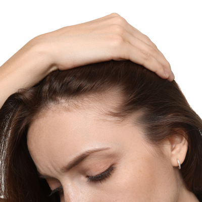 ONLINE HAIR LOSS TREATMENTS FOR WOMEN UK ONLINE HAIR LOSS TREATMENTS FOR WOMEN UK
