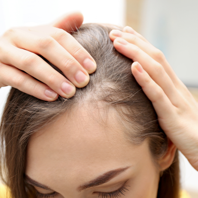 ONLINE PHARMACEUTICAL HAIR LOSS SERUMS UK ONLINE PHARMACEUTICAL HAIR LOSS SERUMS UK