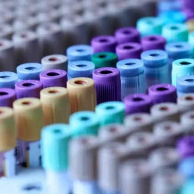 genetic testing for hair loss at The Hair Loss Clinic Uk genetic testing for hair loss at The Hair Loss Clinic Uk