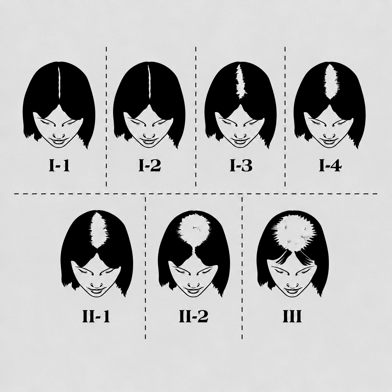 Get The Right Hair Loss Treatment at The Hair Loss Clinic UK