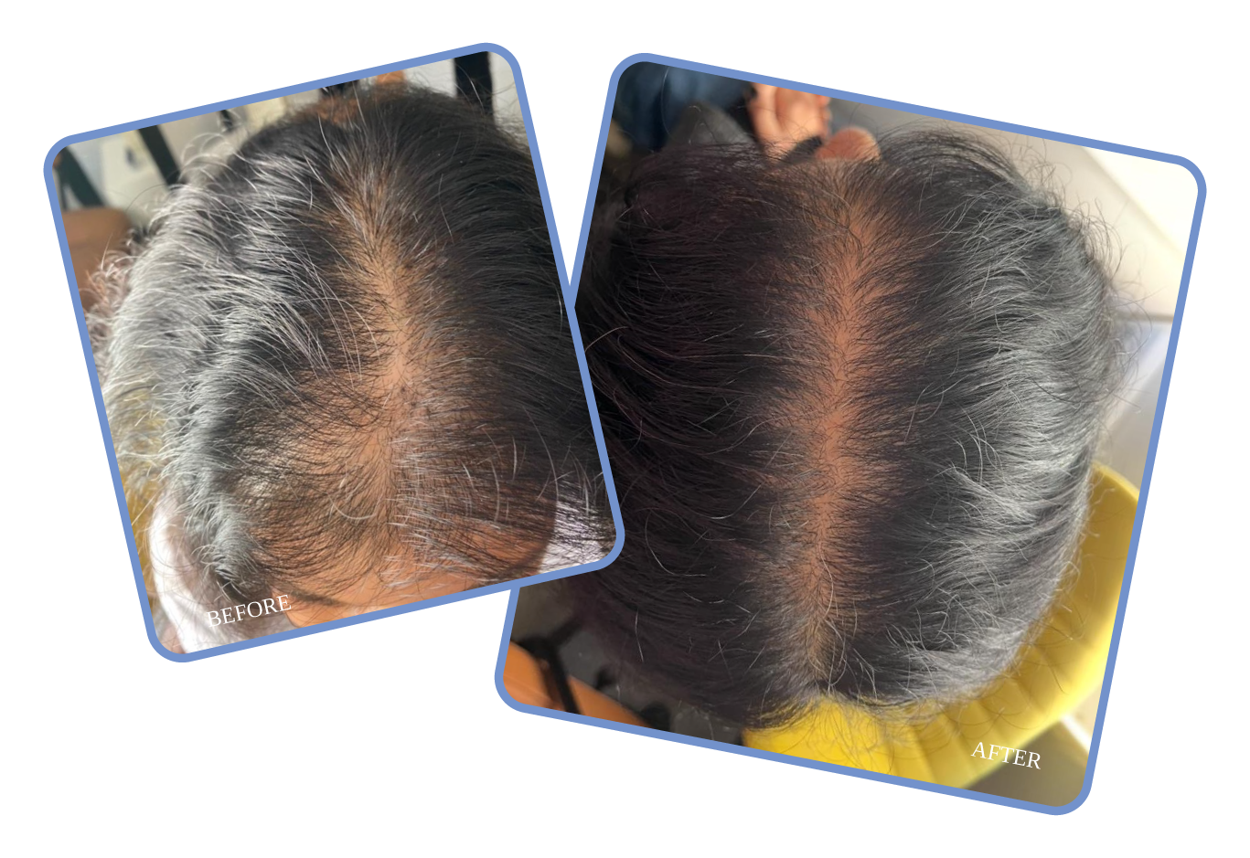 womens before and after banner womens before and after banner
