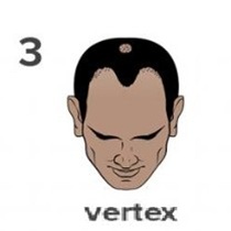 Stage 3 Vertex