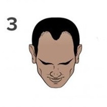 Stage 3