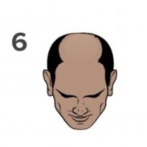 Stage 6