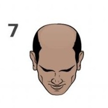Stage 7