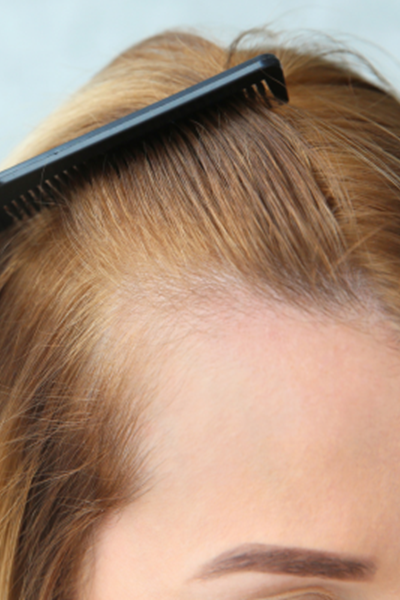 how to reduce side effects with hair loss serums how to reduce side effects with hair loss serums